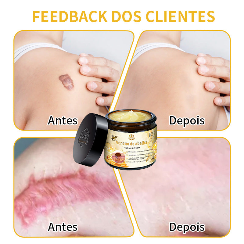 𝑇𝑢𝑟𝑜𝑛𝑢™ Creme de tratamento cutâneo à base de veneno de abelha🐝 (Recomendado pelo DGS) 🌸