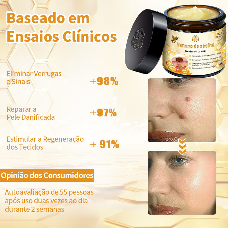 𝑇𝑢𝑟𝑜𝑛𝑢™ Creme de tratamento cutâneo à base de veneno de abelha🐝 (Recomendado pelo DGS) 🌸